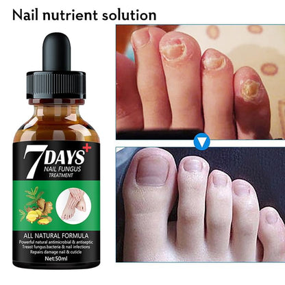 7DAYS Nail Fungus Treatment Serum Care Hand And Foot Care Removal.