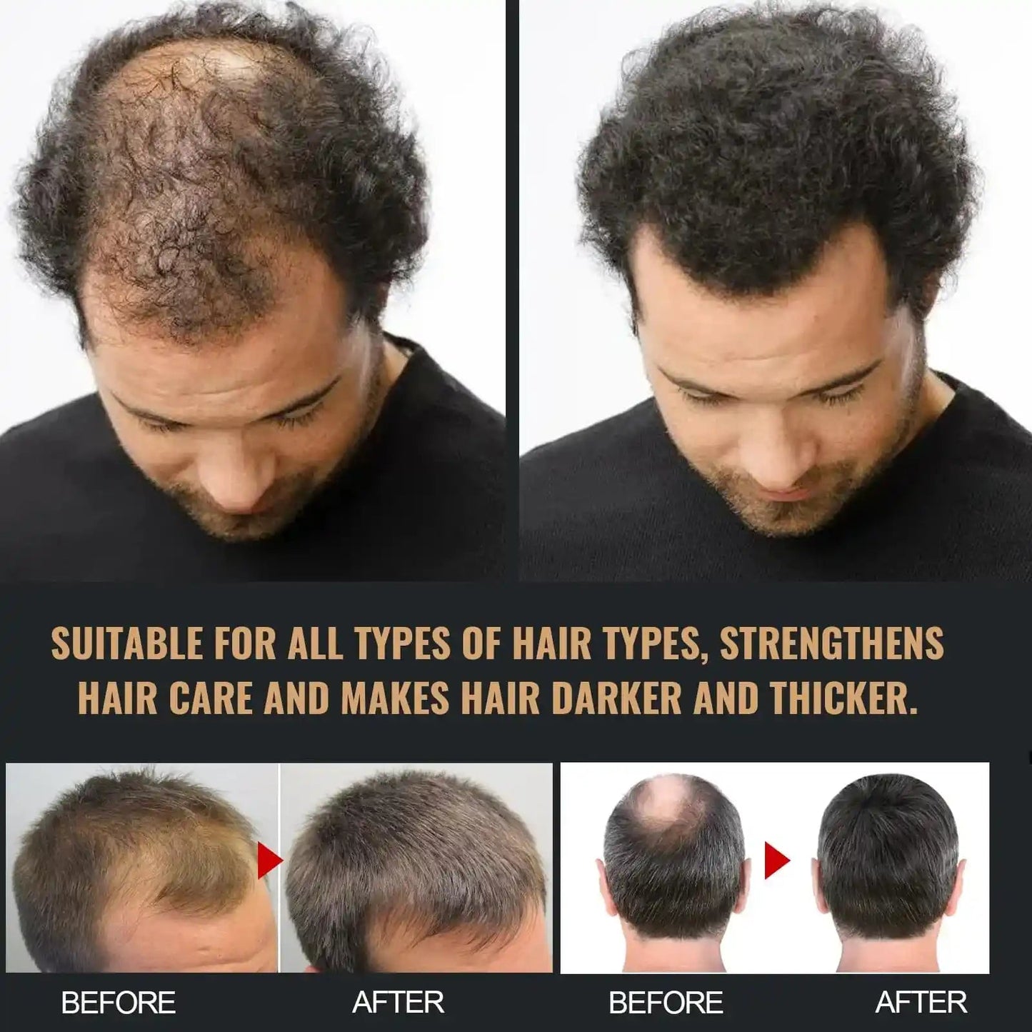 Anti-hair Loss Solid Thick Fluffy Hair Soft Strong Repair Shampoo.