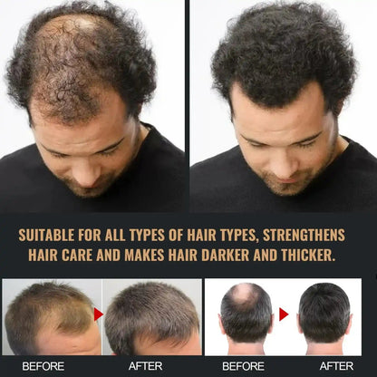 Anti-hair Loss Solid Thick Fluffy Hair Soft Strong Repair Shampoo.
