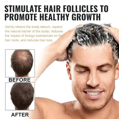 Anti-hair Loss Solid Thick Fluffy Hair Soft Strong Repair Shampoo.