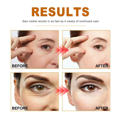 Collagen Anti-wrinkle Serum Lightens Spots Hydrates And Moisturizes.