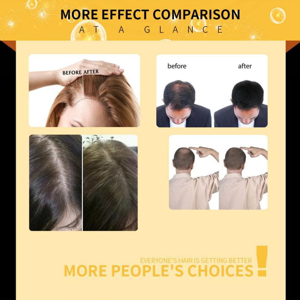 Damaged Hair Repair Women Men's Fast Hair Growth Essence Oil Anti-hair Loss Lotion.