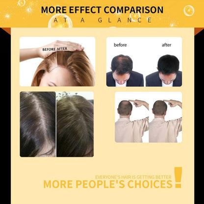 Damaged Hair Repair Women Men's Fast Hair Growth Essence Oil Anti-hair Loss Lotion.