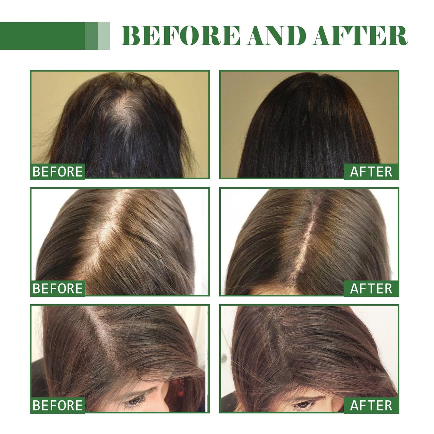Dense Hair Oil Moisturizing Soft Hair Repair.