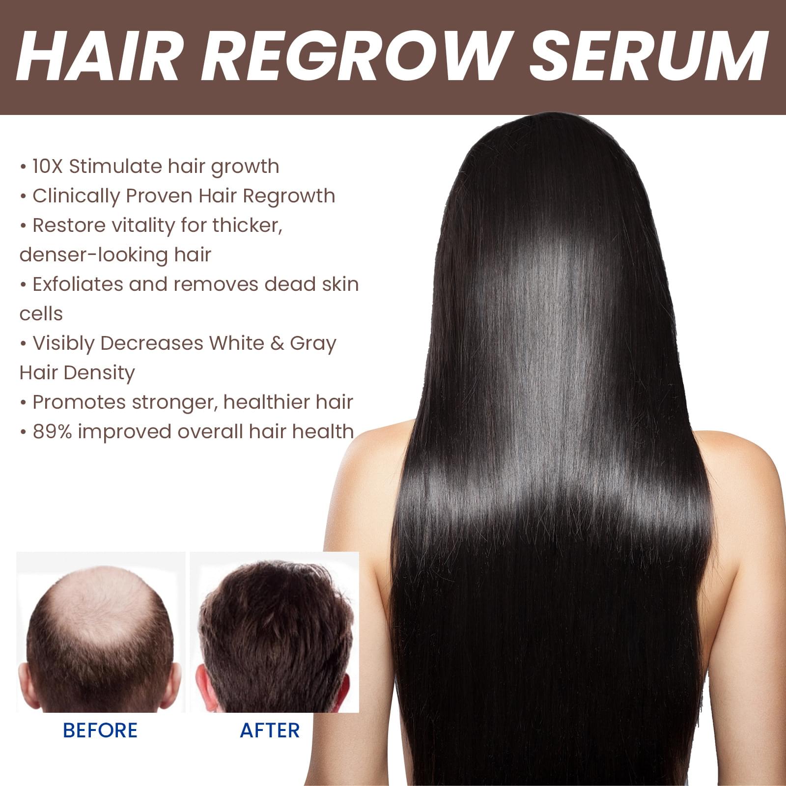 EELHOE Hair Dense Essence Hair Anti-hair Loss And Hair Fixation Nutrition.