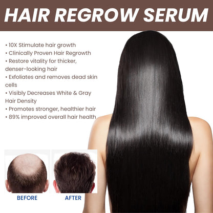 EELHOE Hair Dense Essence Hair Anti-hair Loss And Hair Fixation Nutrition.