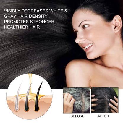 EELHOE Hair Dense Essence Hair Anti-hair Loss And Hair Fixation Nutrition.