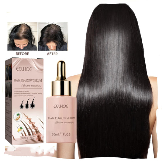 EELHOE Hair Dense Essence Hair Anti-hair Loss And Hair Fixation Nutrition.