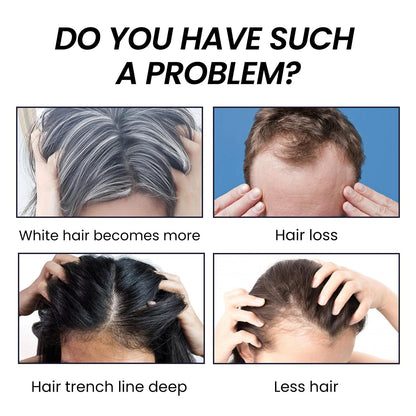 EELHOE Hair Dense Essence Hair Anti-hair Loss And Hair Fixation Nutrition.