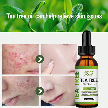 Essential Tea Tree Oil Massage Essential Oil Acne Fade.