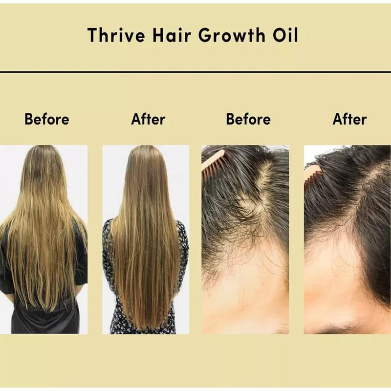 Hair Essential Oil Improve Dryness And Irritability And Nourish.