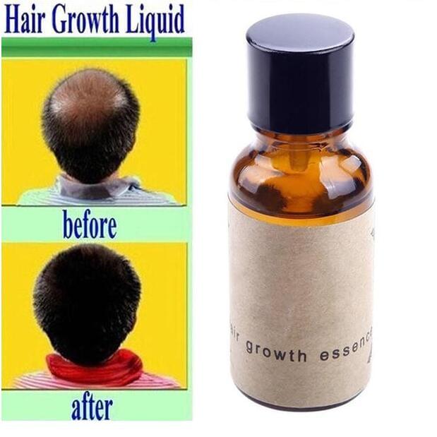 Hair growth liquid.