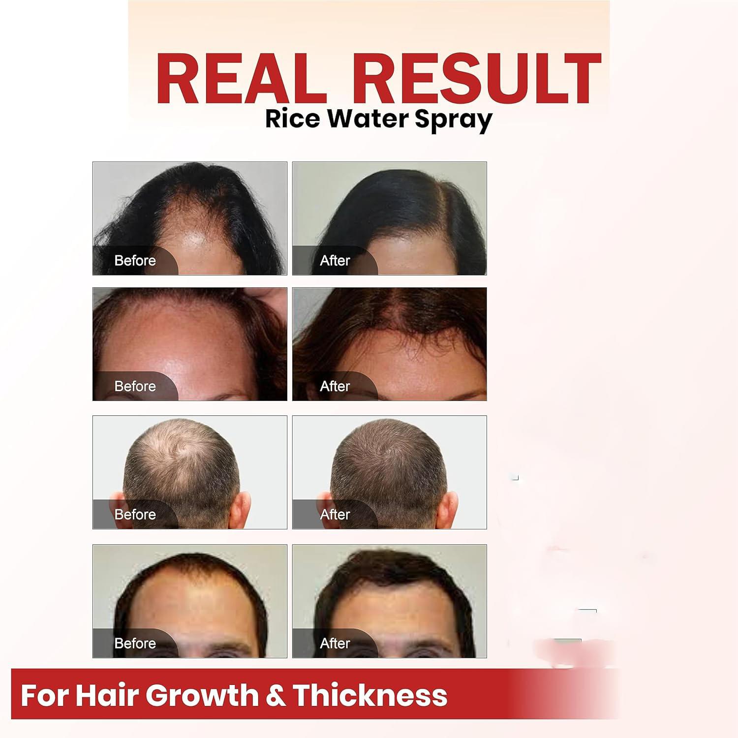 Hair Growth Spray Batana Oil Spray Natural Hair Growth Spray.