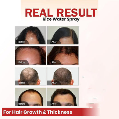 Hair Growth Spray Batana Oil Spray Natural Hair Growth Spray.
