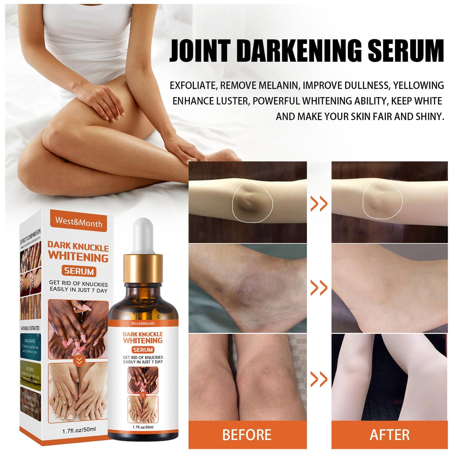 Joint Darkening Serum To Lighten Melanin.