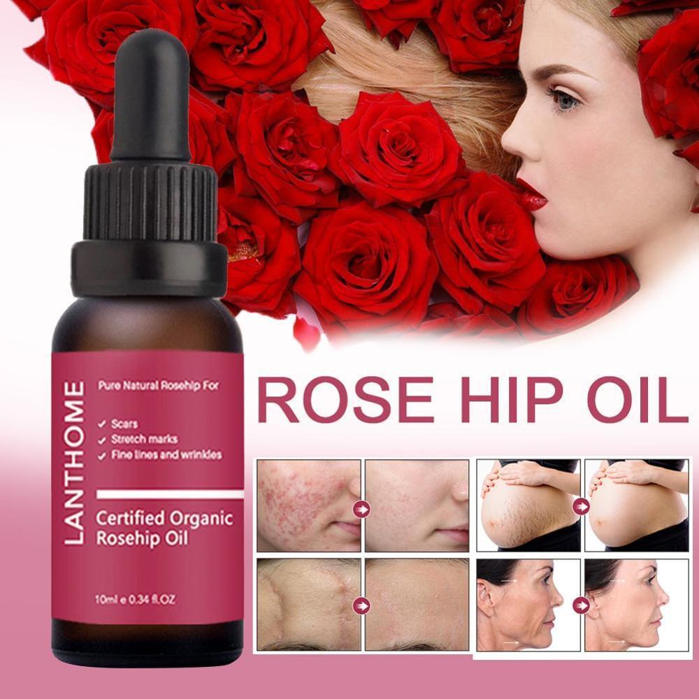 Moisturizing and moisturizing rosehip oil.