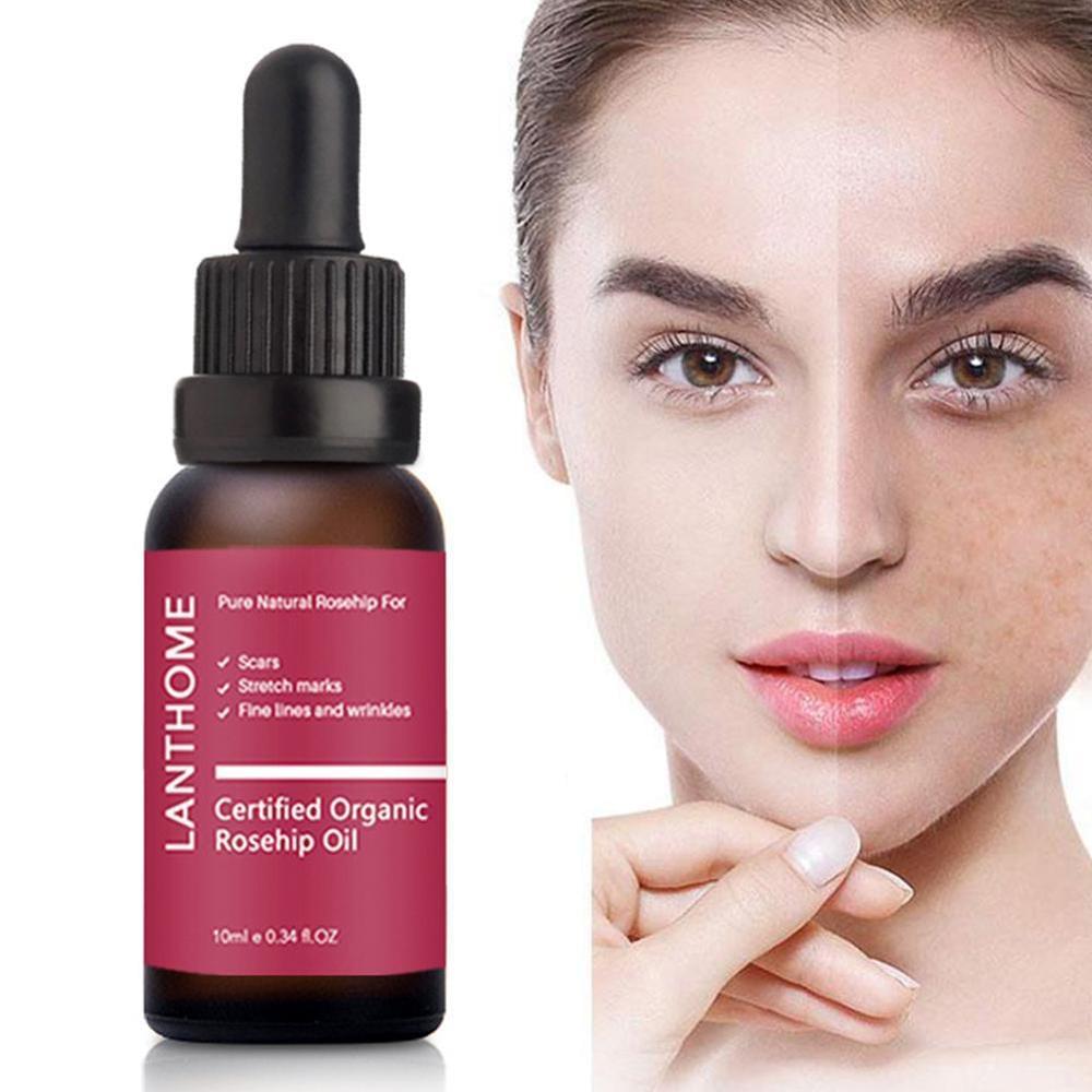Moisturizing and moisturizing rosehip oil.