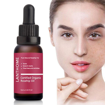 Moisturizing and moisturizing rosehip oil.