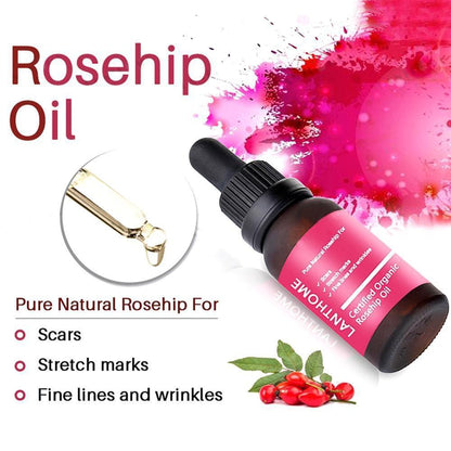 Moisturizing and moisturizing rosehip oil.
