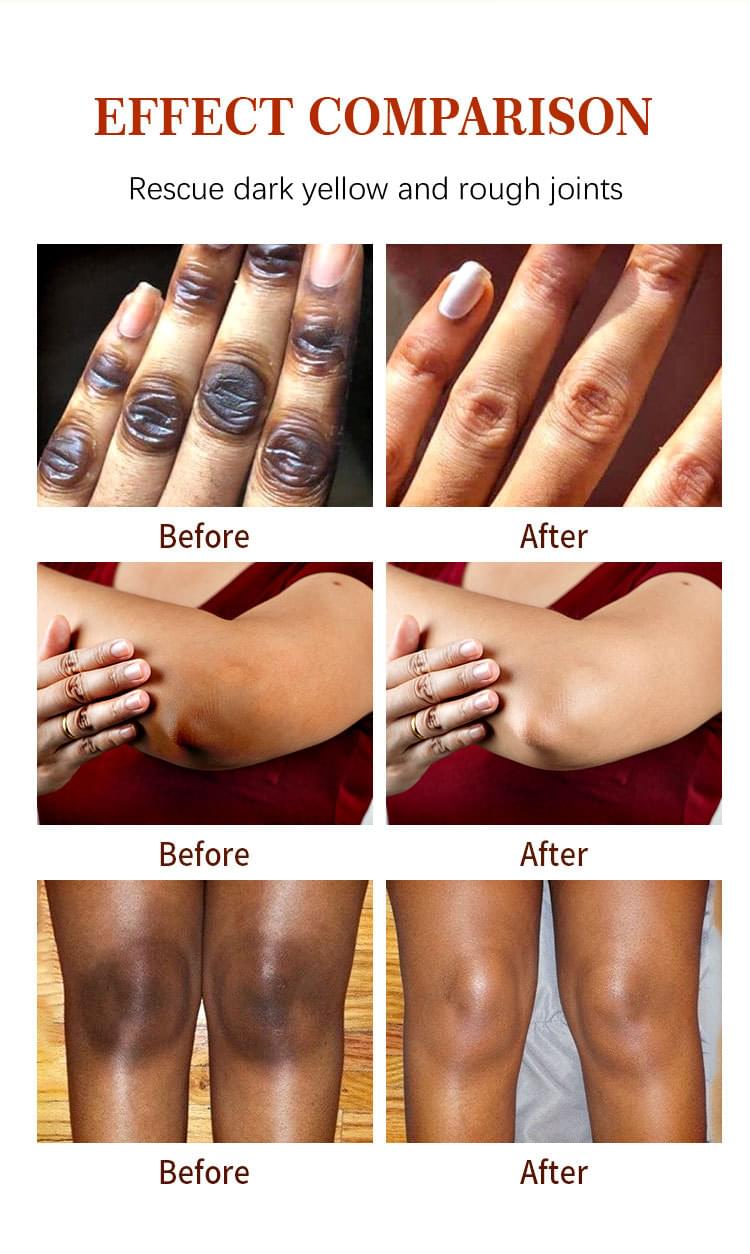 Moisturizing Finger Joint Brightening Serum 50ml.