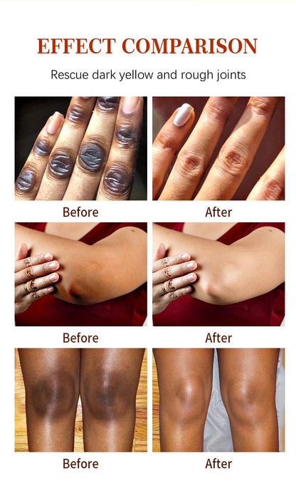 Moisturizing Finger Joint Brightening Serum 50ml.