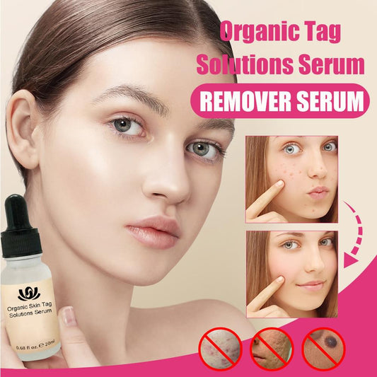 Organic Tags Solutions Serum No Trace Painle Skin Tag Remover Serum Mole Removal Cream Painless Face Wart Mole Freckle.