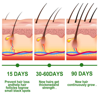 Rosemary Anti-Breakage Nourishing Hair Care Oil.