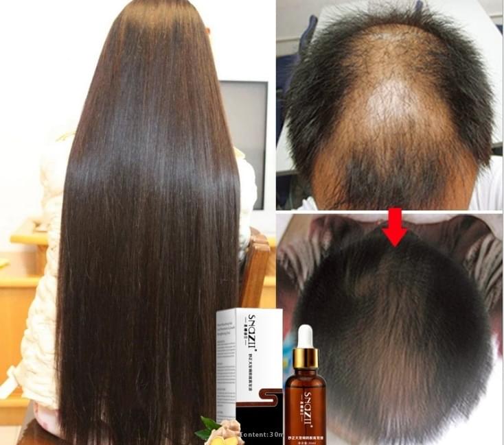 Senna Hair Growth Fluid.