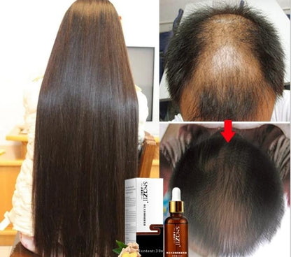 Senna Hair Growth Fluid.