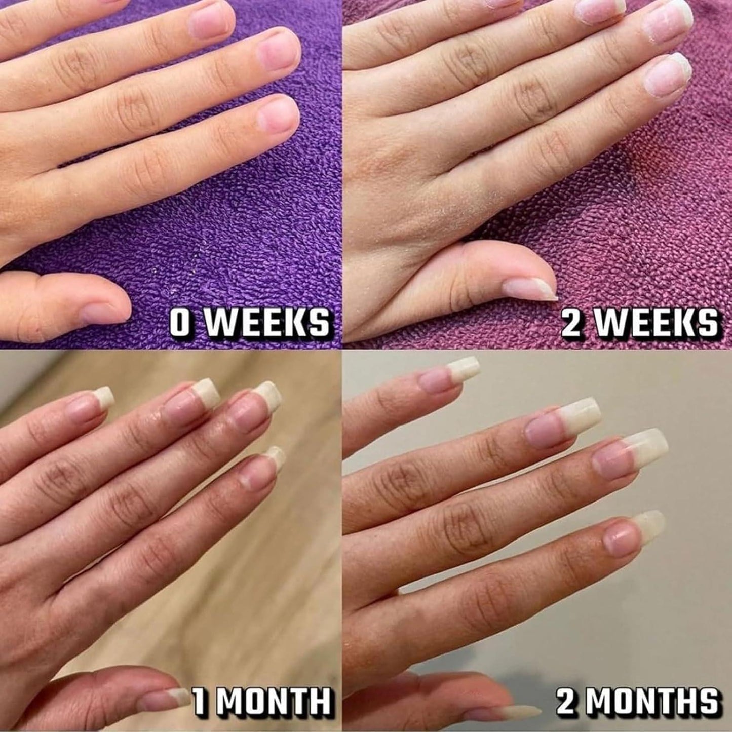 Vitality Nail Growth Oil Enhances Strength And Moisture.