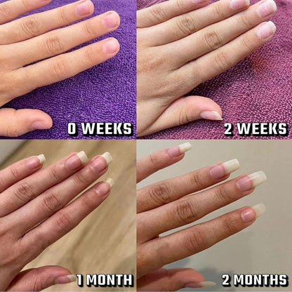 Vitality Nail Growth Oil Enhances Strength And Moisture.